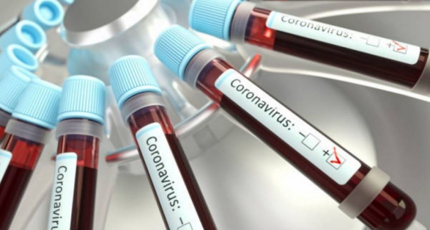 COVID-19: Suman 8 las víctimas fatales. Murieron dos mujeres, una en la Capital y otra en Chaco