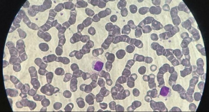 Estudio argentino evidencia la necesidad de tres dosis ante la variante Ómicron