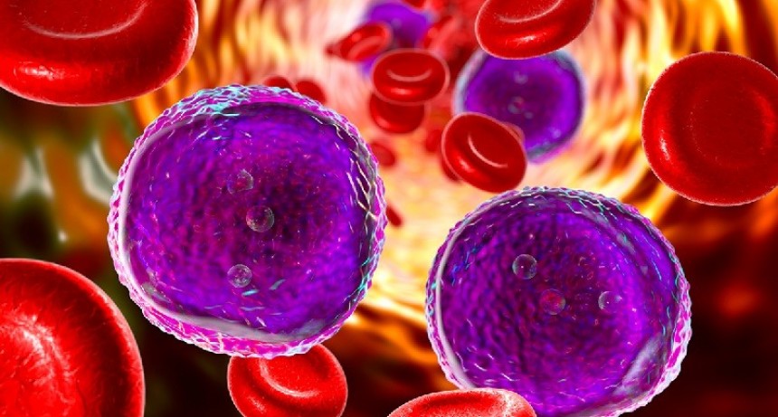 Síndromes mielodisplásicos: Una enfermedad poco conocida que afecta a la médula ósea