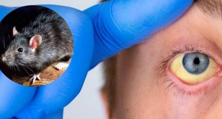 Nación brinda soporte y acompañamiento técnico a los niveles provinciales y locales para el manejo de la leptospirosis