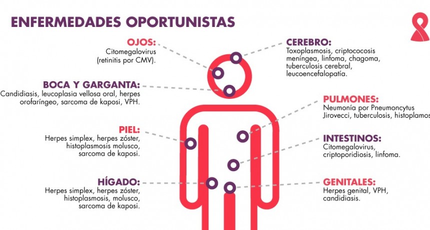 Berisso: Jornada de test rápido de VIH en el Día Mundial de la Lucha contra el SIDA 