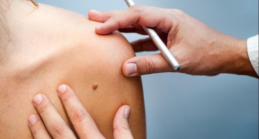 Ituzaingó: Campaña de prevención del cáncer de piel 